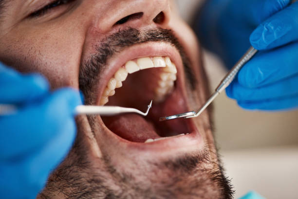 Best Mobile Emergency Dentist in Kennedy, CA