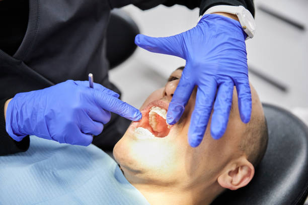 Best Emergency Dental Extractions in Kennedy, CA