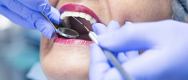Best Emergency Dental Services for Seniors in Kennedy, CA
